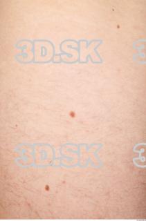 Skin texture of Otakar 0004